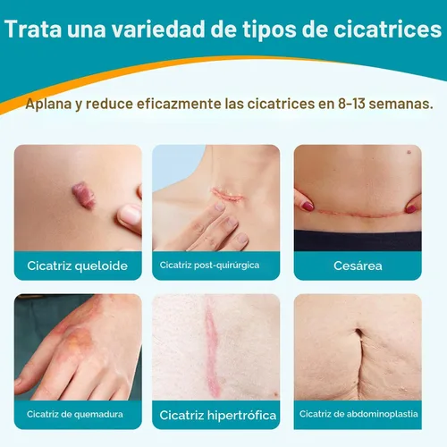 Vista 10 de Dimora UPF50+ - Hojas de silicona para cicatrices con protección UV, rollo de 1.6 x 78.7 pulgadas Protección UV, reutilizable, suaviza, aplana