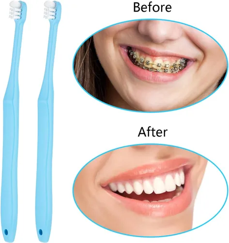 Vista 3 de WLLHYF 2 Piezas Cepillo de Dientes de Mechón Cabeza Pequeña Extremo Cónico Wisdom Interdental Interespacio Cuidado Suave Cepillo de Dientes Pequeño
