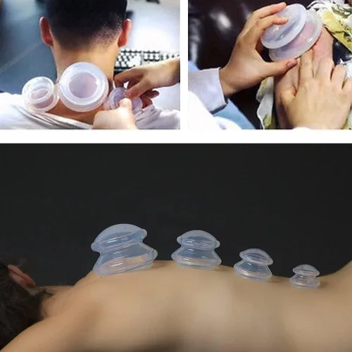 Vista 6 de Shinefuture Juego de terapia de ventosas, kit de 5 piezas de silicona para masaje, masajeador de celulitis, ventosas para masaje corporal