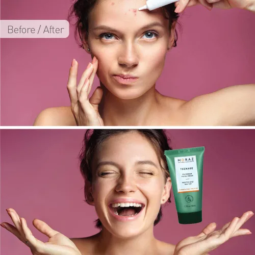Vista 5 de Moraz Polygonum - Crema facial que ayuda a reducir los problemas de piel grasa de los adolescentes, crema facial, hidratante facial, tratamiento