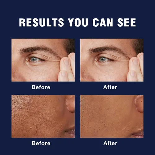 Vista 4 de Crema facial 6 en 1 para hombres – Crema facial antienvejecimiento para hombre con cafeína y retinol para reafirmar, hidratar y refrescar la piel