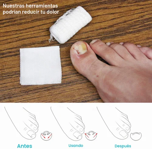 Vista 6 de 2 piezas encarnadas levantador de uñas encarnadas herramienta de uñas encarnadas abrazadera del dedo del pie de acero inoxidable herramienta
