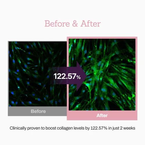 Vista 5 de Suero potenciador de péptido de colágeno 12X, mejora la elasticidad de la piel y reduce las arrugas profundas, promueve la producción de colágeno