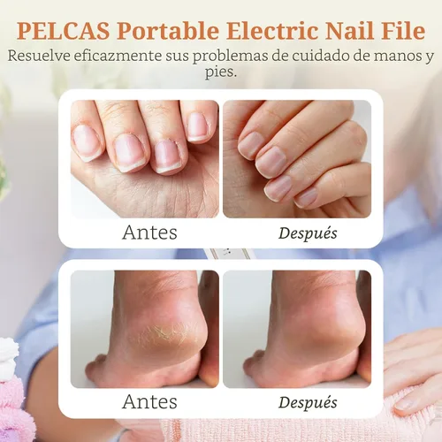 Vista 2 de PELCAS Lijadora Eléctrica de Uñas de los Pies para Uñas Gruesas, Kit de Manicura y Pedicura de 5 Velocidades, Taladro de Uñas Inalámbrico con Luz