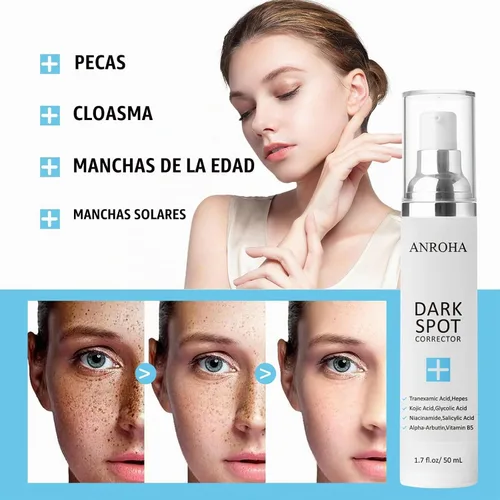 Vista 3 de Removedor de manchas oscuras para cara, corrector de manchas oscuras para cara, removedor de manchas solares, corrector de manchas de edad