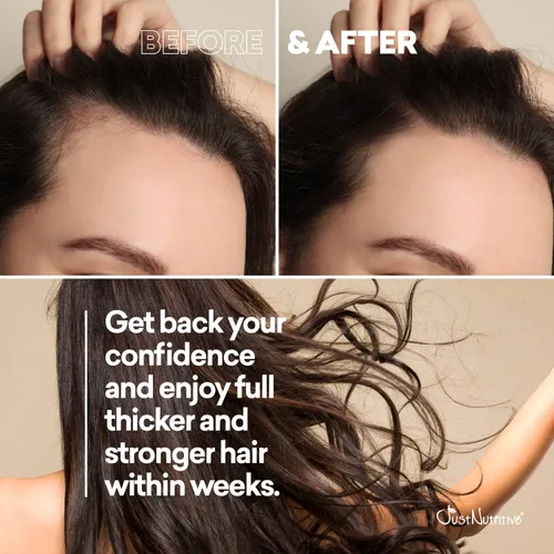 Vista 4 de Grow New Hair Shampoo Crecimiento saludable del cabello Champú natural Para hombres y mujeres Cuidado del cabello Crecimiento del cabello