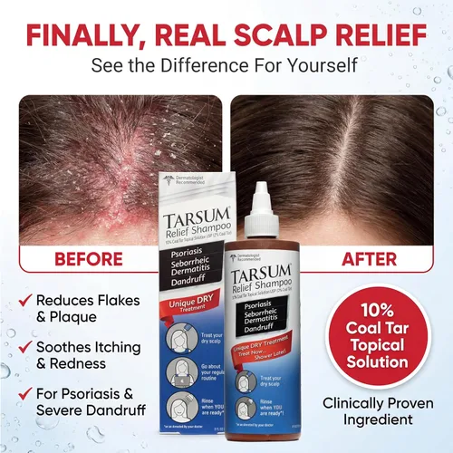 Vista 2 de Tarsum Champú para psoriasis extra fuerte, champú y acondicionador de alquitrán de carbón para psoriasis del cuero cabelludo, dermatitis seborreica