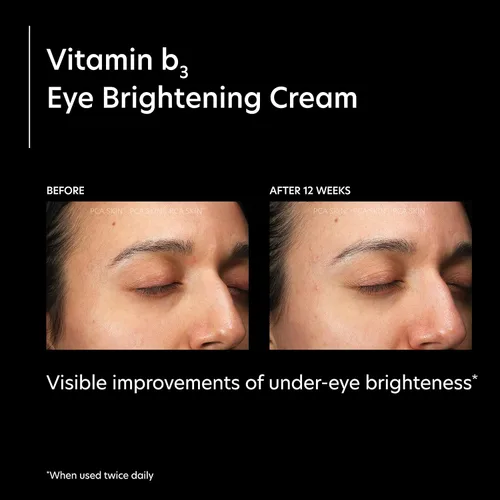 Vista 5 de PCA SKIN Crema iluminadora de ojos con vitamina B3, abrillantador de ojos para ojos brillantes, ojeras, arrugas y tonos desiguales de la piel, crema