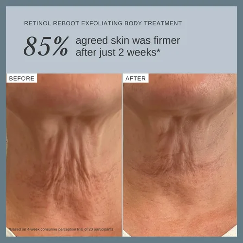 Vista 6 de Alpha-H Retinol Reboot Tratamiento Corporal Exfoliante 4.1 fl oz - Firme, Suaviza e ilumina la piel del cuerpo - Reduce la apariencia de líneas