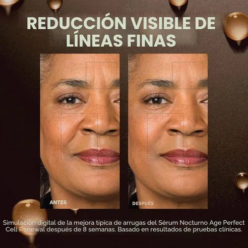 Vista 5 de L'Oreal Paris Age Perfect - Suero facial antienvejecimiento de medianoche, reduce las arrugas, 1 oz + muestra de crema para ojos