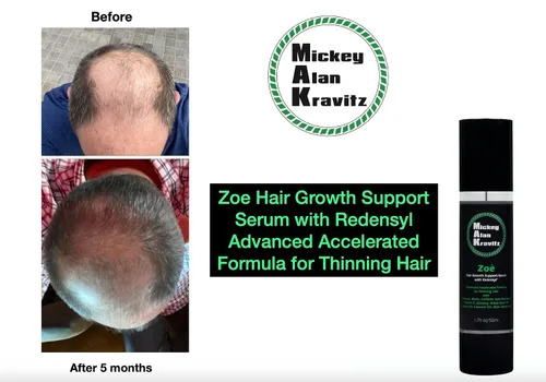 Vista 2 de Zoe - Suero de apoyo al crecimiento del cabello con Redensyl, fórmula acelerada avanzada para adelgazar el cabello