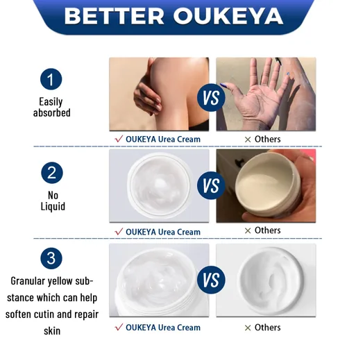 Vista 6 de OUKEYA Crema de Urea 40 Por Ciento, Crema para Manos y Pies para Sequedad y Grietas, Loción de Urea para Pies de Fuerza Máxima (350g)
