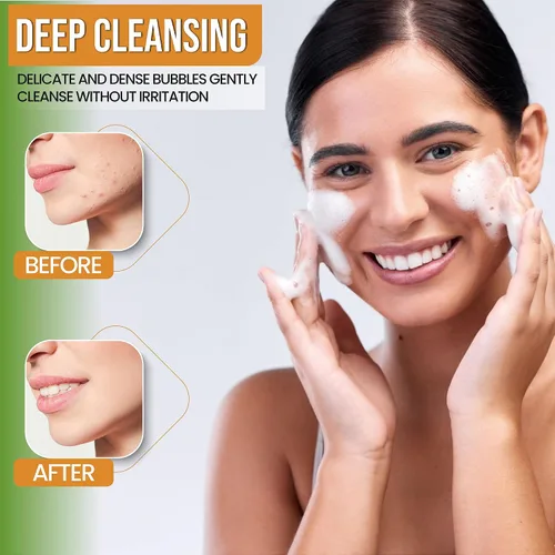Vista 3 de AMVital Jabón facial de cúrcuma – Limpiador facial de cúrcuma con aloe vera, vitamina E y extractos naturales – Lavado facial de gel diario ligero