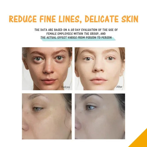 Vista 3 de Suero de vitamina C y suero de retinol, juego de suero antienvejecimiento con ácido hialurónico - Mañana C y noche Un suero para el cuidado facial