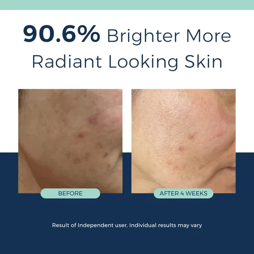 Vista 6 de Suero de colágeno con retinol antienvejecimiento para rostro: retinol encapsulado al 1%, niacinamida y ácido hialurónico, mejora las arrugas