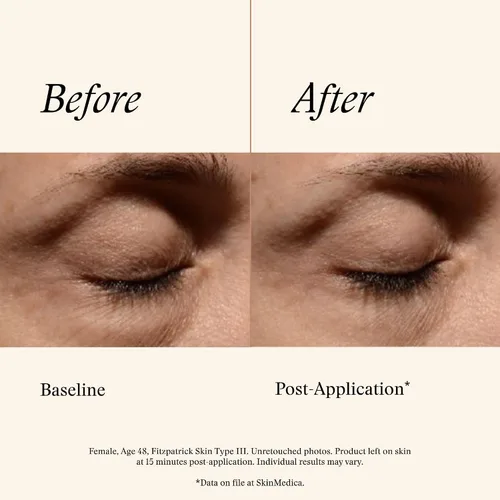 Vista 12 de SkinMedica Instant Bright Eye Cream - Our Age-Defying Under the Eye Cream Instantly Improves Eyes’ Appearance, Including Dark Circles, Sagging