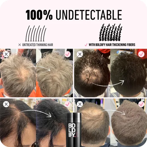 Vista 6 de Boldify Build & Conceal Bundle - Fibra capilar y polvo de línea capilar (rubio oscuro): espesante indetectable para cabello fino, retoque