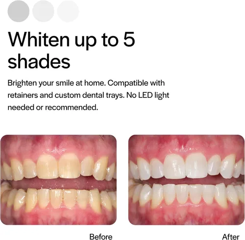 Vista 4 de Opalescence Kit de recambio de blanqueamiento dental con jeringas de gel al 15%, baja sensibilidad (2 paquetes/4 jeringas), menta fresca, peróxido
