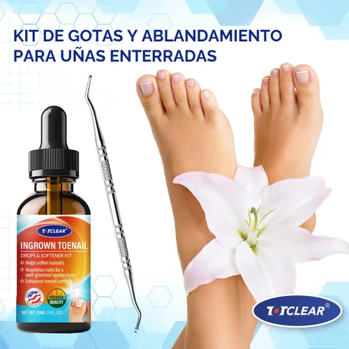 Vista 7 de Alivio de Uñas Encarnadas: Herramienta para Uñas Encarnadas para Hombres Mujeres - Kit de Eliminación de Uñas Encarnadas - Gotas Correctoras de Uñas