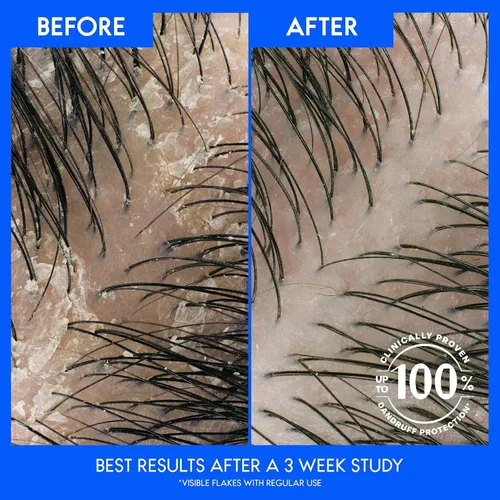 Vista 4 de Head & Shoulders Dry Scalp Care Champú anticaspa paquete doble, protección de 72 horas, aceite de almendras, 32.1 onzas líquidas cada uno