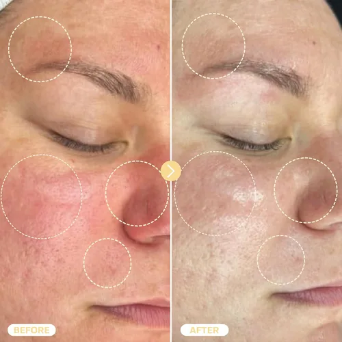 Vista 5 de BASE LABORATORIES Spray de Ácido Hipocloroso para Cara y Piel - Tamaño de Viaje - Spray Tónico Facial y Limpiador - Solución de Reparación