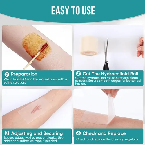 Vista 8 de Rollo hidrocoloide para el cuidado de heridas, vendajes de parche hidrocoloide con vendajes autoadhesivos, para úlceras de cama, altamente