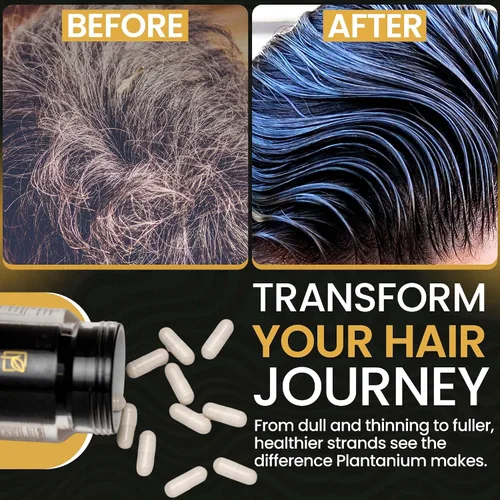 Vista 7 de Las mejores vitaminas para el crecimiento del cabello para mujeres y hombres apoyan el crecimiento del cabello más rápido y una mejor salud