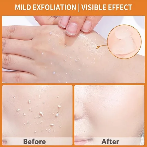 Vista 4 de Gel exfoliante de enzimas naranjas, exfoliante facial de gel natural para pelar naranja, exfoliante facial hidratante de limpieza profunda