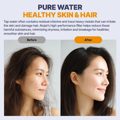Vista 7 de Filtro de ducha Aqua Detox influenciado por la tradición de belleza de Corea. Alivia la sequedad y la irritación mientras mejora la salud de la piel