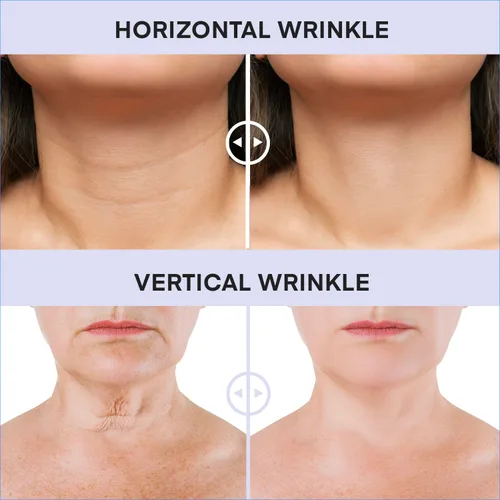 Vista 6 de Crema Reafirmante para el Cuello, Crema Reafirmante del Cuello para Tensar y Reafirmar, Líneas Finas, Flacidez y Descolgamiento en el Rostro, Escote