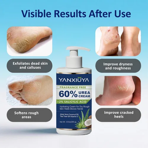 Vista 4 de Crema de urea 60% de 10.5 onzas, loción corporal sin fragancia con 2% de ácido salicílico, crema de pies y para pies, talones agrietados, removedor