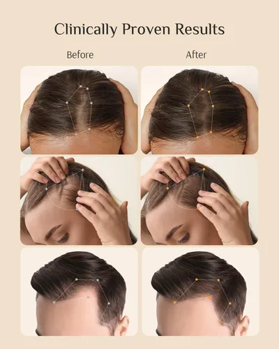 Vista 3 de DR ZERO REDENICAL Acondicionador de crecimiento del cabello para mujeres, 13.5 onzas, tratamiento voluminizador de espesamiento y anti pérdida