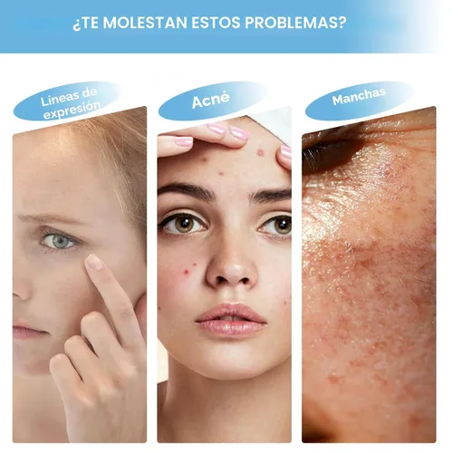 Vista 3 de Niacinamida 10% + Zinc 1% suero para la cara – Control de aceite, acné, reductor de poros y reducción de imperfecciones – Suero facial ligero,