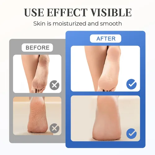 Vista 4 de Crema Hidratante y Antigrietas para Pies, Crema de 2025 ml Hidratante y Alivio de Grietas y Sequedad para Pies, Crema de Reparación para Manos