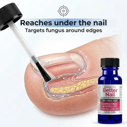 Vista 2 de Better Nail - Tratamiento para hongos debajo y alrededor de la uña - Fuerza máxima, solución antifúngica al 25% para el soporte de las uñas