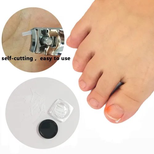 Vista 2 de Tratamiento de uñas encarnadas, 50 tiras correctoras de uñas encarnadas transparentes, herramienta profesional de tratamiento de uñas sin pegamento