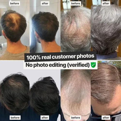Vista 8 de IMPERIO Fibras de construcción del cabello para adelgazar el cabello, 0.92 oz de fibras capilares de primera calidad para mujeres y hombres