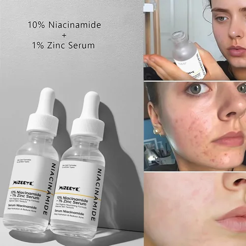 Vista 2 de Suero facial de niacinamida 10% + zinc 1% para niñas y mujeres, suero hidratante de niacinamida para el acné, enrojecimiento.