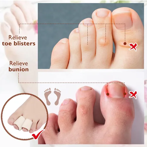 Vista 5 de Tondiamo 6 fundas protectoras de espuma para dedos de los pies, juanetes, martillo, callo, ampolla, dolor (M, beige)