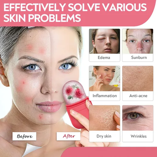 Vista 4 de AURUZA 2 rodillos de hielo para cara y ojos, rodillo facial de hielo, herramientas de belleza para el cuidado de la piel, soporte de hielo, cubo