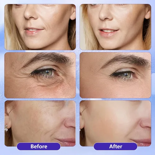 Vista 3 de Suero facial de ácido hialurónico, suero facial de vitamina C, suero de niacinamida, suero de cuidado de la piel facial para rellenar