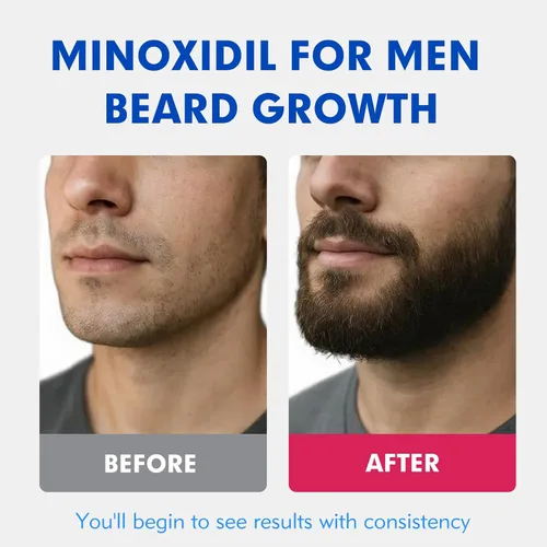 Vista 3 de Fytikal 5% de minoxidil para hombres tratamiento de crecimiento del cabello, solución tópica extra fuerte para adelgazamiento del cabello