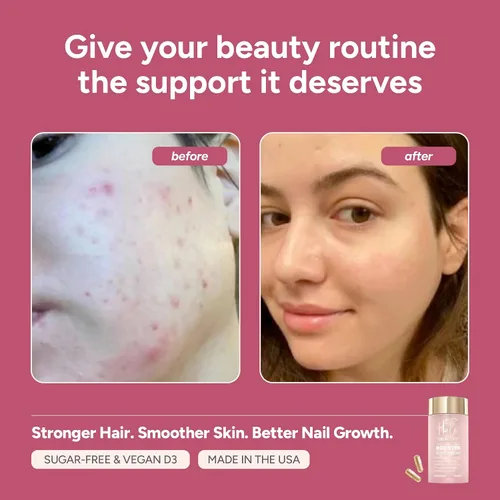 Vista 4 de Halo Beauty Suplemento para la piel y las uñas Crecimiento del cabello más grueso, piel radiante y uñas fuertes con biotina, palma enana americana
