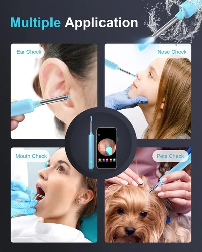 Vista 4 de DJROLL Eliminación de cera de oído, herramienta de eliminación de cerumen, cámara de oído, visor de oído con herramienta limpiadora de cera de oído