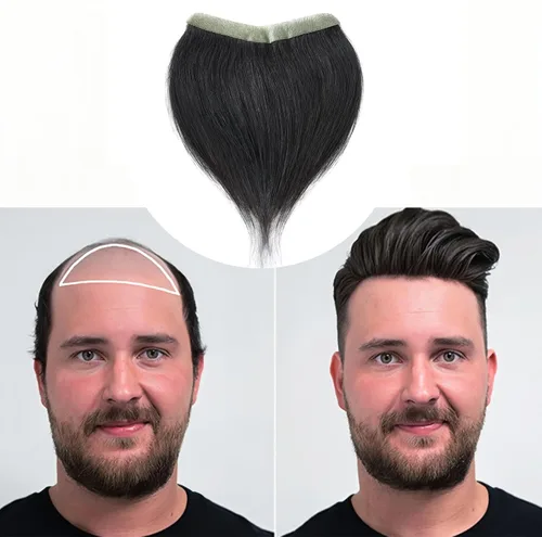 Vista 27 de Extensión frontal de cabello rubio claro para hombres, extensión de cabello lacio con pérdida de línea de cabello humano con cinta adhesiva