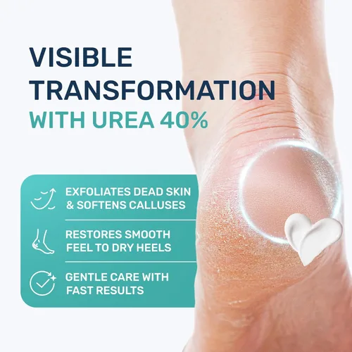 Vista 2 de Crema de urea 40 por ciento para pies de máxima fuerza, crema de urea para pies y removedor de callos, crema exfoliante para talones con ácido