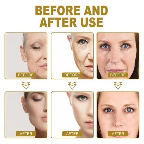 Vista 4 de Crema antiarrugas de colágeno, crema facial antienvejecimiento dorada, crema facial de colágeno para mujeres, antienvejecimiento, hidratante facial