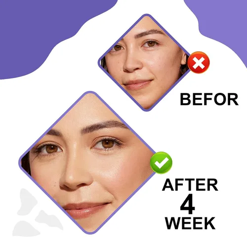 Vista 8 de Crema de noche con retinol y ácido hialurónico, hidratante facial antienvejecimiento, crema facial de retinol antienvejecimiento para mujeres