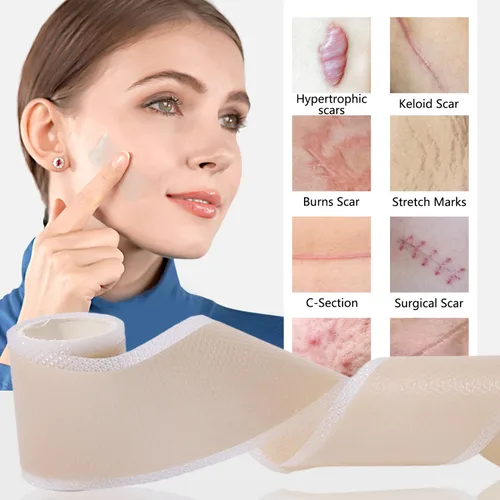 Vista 6 de Láminas de silicona anchas impermeables para reparación de la piel, cubierta autoadhesiva, tatuajes, cicatrices, calcomanías para el cuidado