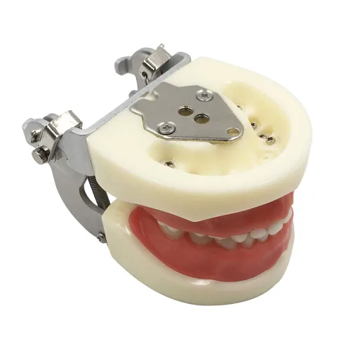 Vista 4 de Typodont - Modelo de dientes para niños, con 24 dientes extraíbles, compatible con Kilgore Nissin para enseñanza, estudio
